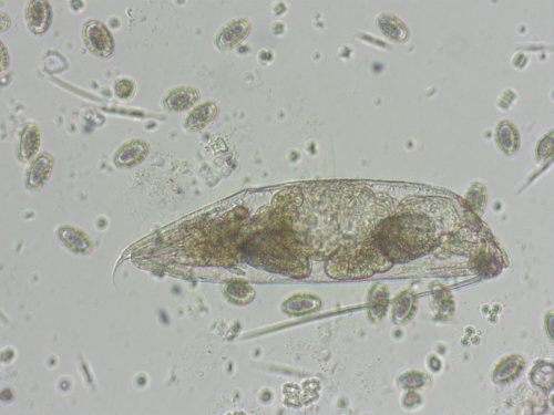 A microscopic image of a freshwater rotifer. Green can be seen inside it's transparent oval like body.