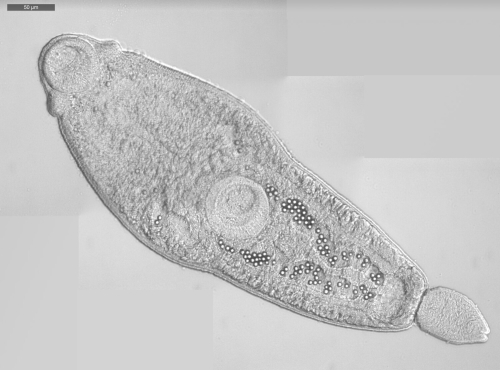A microscopic image of a marine trematode. It's internal organs are visible through it's transparent body.